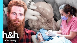 SEM CENSURA: 3 cirurgias bem de perto | Dra Sandra Lee: A Rainha dos Cravos | Discovery H&H Brasil