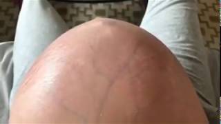 Veiny Pregnant Belly Movements