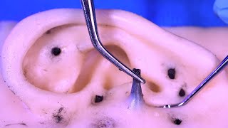Asmr exprimiendo puntos negros | Visita dermatológica | ASMR Español | Asmr with Sasha