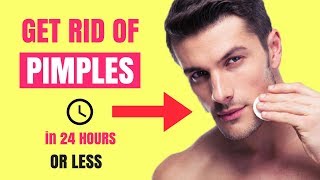 How to INSTANTLY Get Rid of A Pimple Overnight | How to Get Rid of Acne, Blackheads & Scars