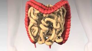 Home Colonic Irrigation Cleansing - Hemorroid Treatment