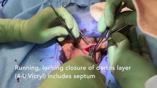 Simple orchiectomy for transgender patients