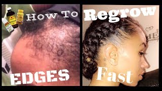 How To Regrow Edges On Natural Hair Fast