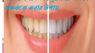 দাঁতের হলদে ভাব দূর করে দাঁতকে ঝকঝকে করার উপায়