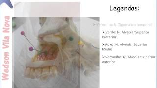 NervoTrigêmeo: [SLIDE] - Anatomia Prática