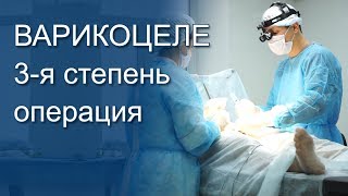 Варикоцеле операция Мармара 3 степень