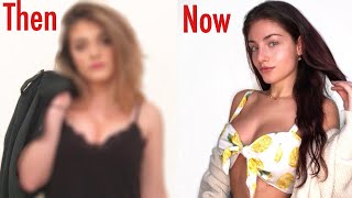 What I looked like before 9 cosmetic procedures! ? *exposing myself* tehe