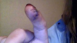 Рыба откусила палец
