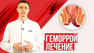геморрой лечение, диагностика, полезные советы