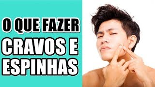 ? O QUE FAZER COM AS ESPINHAS E CRAVOS? feat EI, ANDREW | PELE MASCULINA