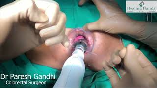 Dr Paresh Gandhi Difficult MIPH Conrad CME Proctology