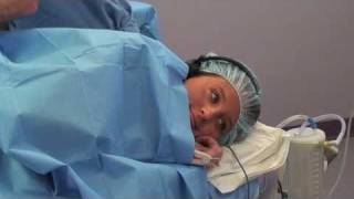 Awake Tumescent Liposuction with Smartlipo Laser - Louisville KY