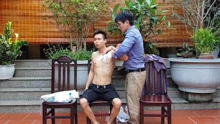 KHI BỊ GÃY XƯƠNG ĐÒN LÊN BÓ BỘT HAY BÓ THUỐC NAM GIẢI PHÁP NÀO NHANH KHỎI NHẤT
