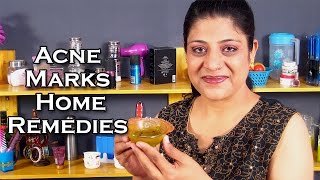 How To Remove Pimple Marks / Home Remedies for Pimple Marks @ ekunji