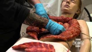 The Knick Season 2: Body Shop  Heroin Addict Autopsy (Cinemax)