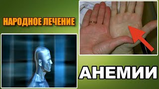 АНЕМИЯ. МАЛОКРОВИЕ. ЛЕЧЕНИЕ АНЕМИИ НАРОДНЫМИ СРЕДСТВАМИ