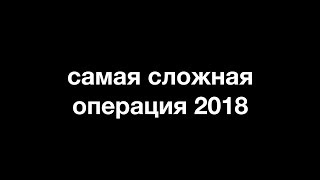 моя самая сложная операция в 2018 году