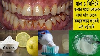 দাঁতের মধ্যে লেগে থাকা ময়লা ও হলুদ দাগ থেকে মাত্র ১ মিনিটে মুক্তি | yellow Teeth to white in bangla