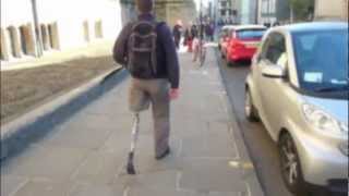 amputee testing VGK (VERY GOOD KNEE) prosthetic leg knee