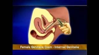 Vaginal Examination (PV) - OSCE Guide