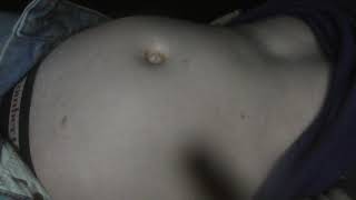 Belly Bulge