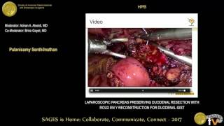 Laparoscopic pancreas preserving duodenal resection with RNY reconstruction for duodenal GIST