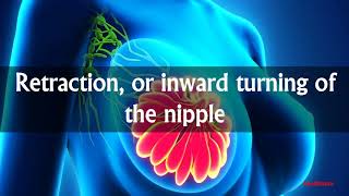 SYMPTOMS OF BREAST CANCER