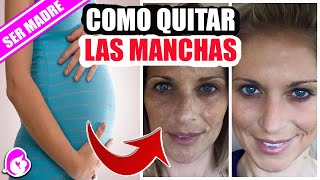 Cómo quitar las manchas en la cara del embarazo