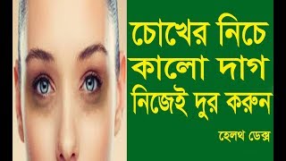 চোখের নিচের কালো দাগ দূর করবেন যেভাবে ভিডিও দেখুন