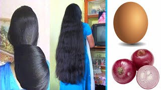 How To Grow Long and Thicken Hair Faster With Egg & Onion !! Super Fast Hair Growth Challenge!