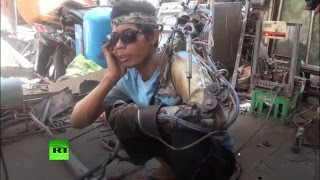 Un homme s’est fabriqué un bras bionique en utilisant des conseils sur Internet
