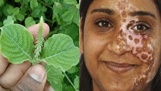 ఒక్కసారి మీ ముక్కు మీద రాస్తే చాలు..2రోజుల్లో మీకున్న మచ్చలు మొత్తం తగ్గిపోతాయి Uthareni plant uses