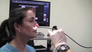 Esophagoscopy Without Sedation (Trans-Nasal Esophagoscopy; Esophagus Exam Endoscopy)