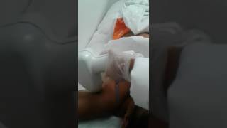 Depilação a laser Millesman