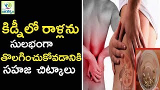 How to Pass Kidney Stones Quickly With This Natural Remedies - Mana Arogyam Telugu Health Tips