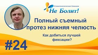 Полный съемный зубной протез на нижнюю челюсть с фиксацией на имплантах