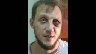 Лечение травмы глаза пиявками
