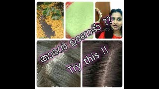 MOST EFFECTIVE DANDRUFF REMEDY!! താരൻ   ഒരു  പ്രശ്‌നമല്ല !!
