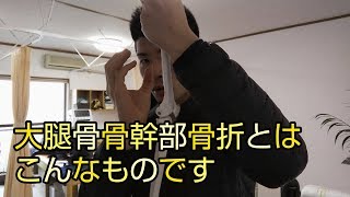 【プチセミナー】大腿骨骨幹部骨折について