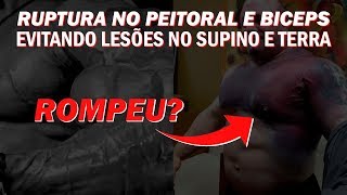 Ruptura de peitoral e bíceps - supino e levantamento terra