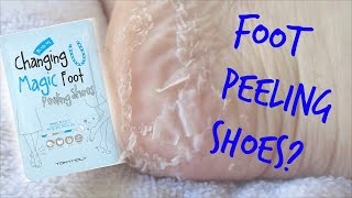 Tony Moly Magic Foot Peeling Shoes|| Baby Feet Dupe? || Warning: Gross