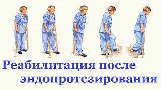 Реабилитация после эндопротезирования