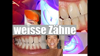 WEISSERE ZÄHNE: schadet BLEACHING meinen Zähnen? wie geht das? TIPPs vom ZAHNARZT