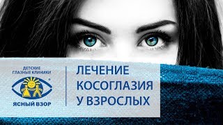 Косоглазие у взрослых. ? Успешное лечение косоглазия у взрослых! Ясный взор