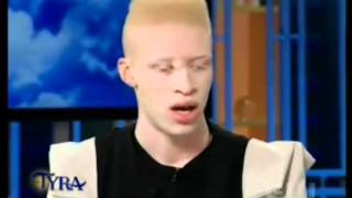 Albino Models on Tyra show