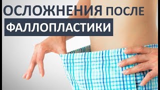 ?ОСТОРОЖНО! Осложнения после увеличения члена!