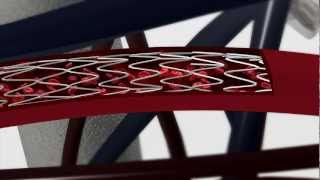 Impotent man cured by heart stent