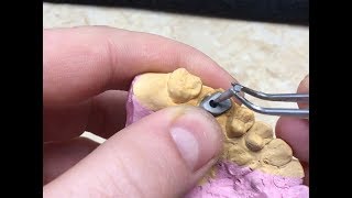 Изготовление разборной культевой штифтовой вкладки.Как сделать культевую вкладку .Зубной техник