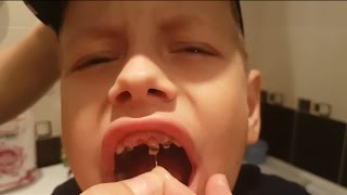 У Бори шатается зуб! Как выпадают молочные зубы у детей / Baby teeth
