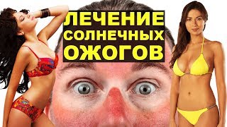 Солнечный ожог кожи, первая помощь и лечение при солнечных ожогах